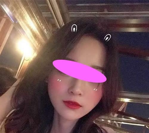 花8600块找上饶尚美整形张维华做膨体+耳软骨隆鼻三个月后,朋友都说这钱没白花 图2