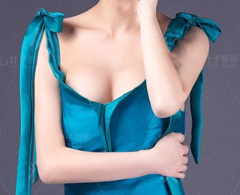 为什么找包头叶子张会堂做曼托假体隆胸300CC手术 因为我胸部平的连男朋友都没找到 图2