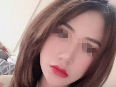 济南宝琳娜做自体脂肪填充挺好的,并且收费价格合理(附照片) 图2