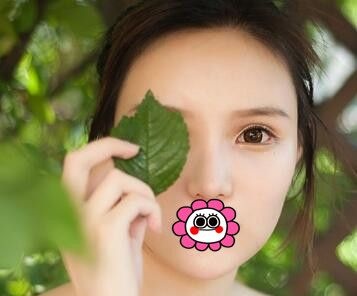 自体脂肪填充面部多久恢复自然呢?用我在辽宁曙光整形外科医院做自体脂肪全脸填充术后64天效果揭秘! 图2