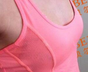相比国产威宁我选择价格略贵的美国进口曼托假体 再加上常州美贝尔内窥镜+双平面技术术后胸部自然无异物感