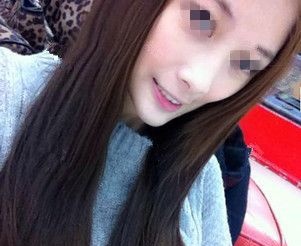 虽然快一万的自体脂肪填充比线雕价格贵,但是选对常州美贝尔专业医院术后没有后遗症成活率还高