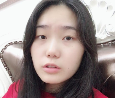 去东莞壹加壹整形医院找梅小霞割完双眼皮后拿到一份双眼皮价格表