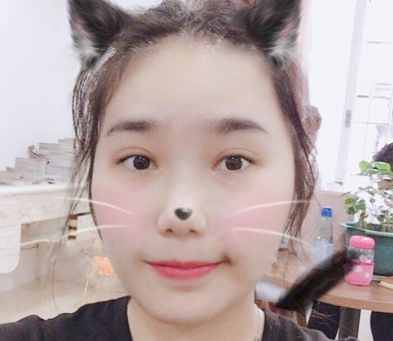 去东莞壹加壹整形医院找梅小霞割完双眼皮后拿到一份双眼皮价格表 案例图2