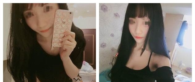 我的自体脂肪隆胸日记，感谢无锡丽都医生精细化注射高成活率，从A到B彻底爱上松软Q弹的feel