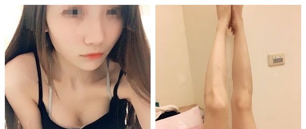 我的自体脂肪隆胸日记,感谢无锡丽都医生精细化注射高成活率,从A到B彻底爱上松软Q弹的feel 图2