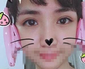 做双眼皮加开眼角后 随便发了一张照片大家居然说我P图了吧 图2