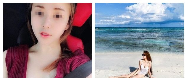 因为胸小惨遭分手后的她花一万多到无锡丽都做了进口娜绮丽假体隆胸,三个月性感身材逆袭打脸前任 图2