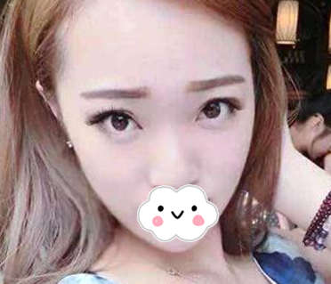 去梅州曙光整形医院找李瑞医生做完双眼皮隆鼻后拿到一份整形价格表