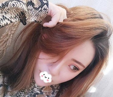 去梅州曙光整形医院找李瑞医生做完双眼皮隆鼻后拿到一份整形价格表 图2