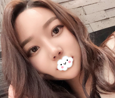 东莞西妃刘波做的鼻子真的太美了,说是妈生鼻也不为过哦 图2