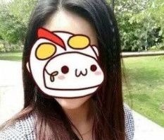 花样年华假体手感硬吗?反正我觉得在唐山苏亚美联臣找李春雷做的240cc假体隆胸手术效果自然还很柔软