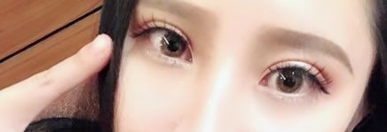 我是一例温州艺星做神话眼综合双眼皮和肋骨鼻综合整形案例,在这里分享我的亲身经验 图2