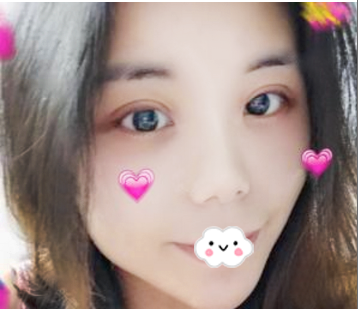 面诊感觉中山美南华整形医院挺正规的就找王斌院长做了全切双眼皮 图2