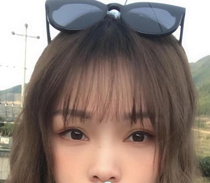 拜拜,眼袋君,我在温州爱尚玉熙整形做内切去眼袋全记录,没眼袋后真是太美好了 图2