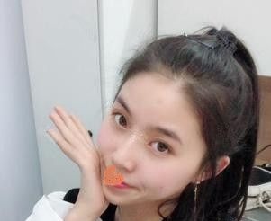 肉肉大饼脸的我一直想拥有精致小V脸 来到张家口天宏找王慧东医生注射一支瘦脸就能轻松搞定 图2