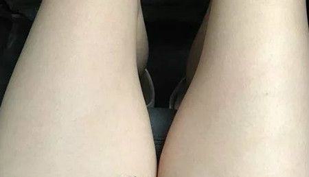 在赣州韩美找何斌做大腿吸脂3个月后我腿细了6cm,分享大腿吸脂后快速恢复技巧给大家