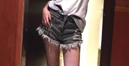 在赣州韩美找何斌做大腿吸脂3个月后我腿细了6cm,分享大腿吸脂后快速恢复技巧给大家 图2