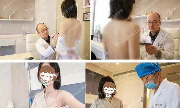 谈谈我在昆明艺星找徐威做麦格假体丰胸295CC真实感受及术后恢复效果