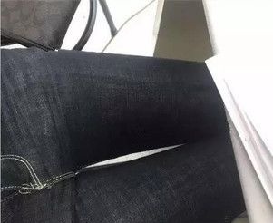 泰州哪里抽脂好?面诊泰州华美、丽都、韩术、奥莱、柏丽等才定下来在丽都大腿吸脂2000ml目前已经术后10天 图2