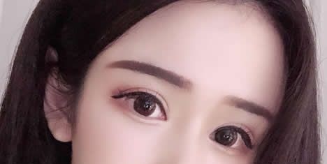 咨询预约杭州艺星整形杨连华做了双眼皮和开眼角后,我知道为什么艺兴做双眼皮价格比较贵啦! 图2