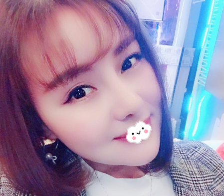 看了东莞隆鼻医院排名后我找东莞壹加壹王擎做了肋软骨隆鼻,给大家分享下术后恢复全过程 图2