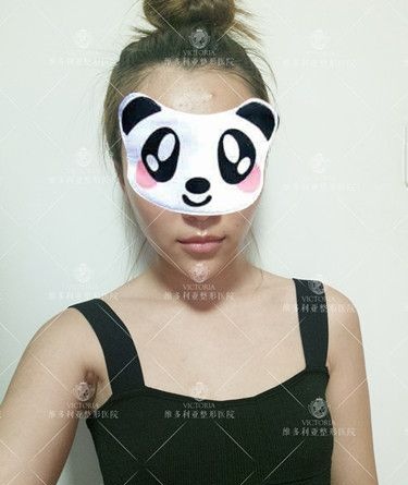 看到同事在张家口维多利亚做自体脂肪丰胸术后效果超自然 面诊李成辉医生后选择适合我的曼托350cc假体隆胸手术
