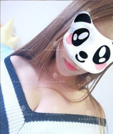 看到同事在张家口维多利亚做自体脂肪丰胸术后效果超自然 面诊李成辉医生后选择适合我的曼托350cc假体隆胸手术 图2