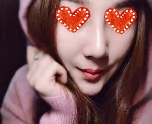 湖南常德德美整形医院怎么样？看我找符恒做硅胶假体+耳软骨综合隆鼻术后40天恢复效果图就知道了！ 案例图2