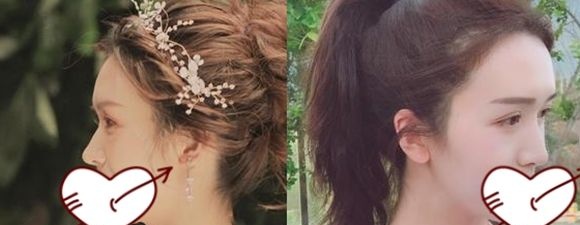 听说千万不要去隆鼻会后悔,看过我在长春中妍整形找刘晓吉做的假体隆鼻前后效果你会懂得..... 图2