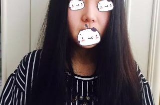 德州做鼻综合手术技术厉害的医院是天宏,给你分享我的手术经历