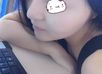 德州做鼻综合手术技术厉害的医院是天宏，给你分享我的手术经历 案例图2