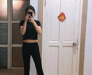 看了哈尔滨臻美暑期吸脂优惠活动,找吕远东做了大腿吸脂+BTL激光紧致告别双腿粗壮 图2