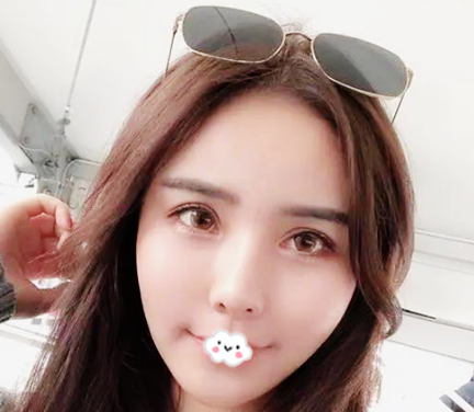 说说我花一万多元找东莞壹加壹朱建生做面部线雕埋线提升的亲身经历和感受 图2