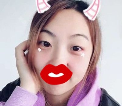 我趁七夕前来洛阳毛大夫做了眼综合手术后用电眼收获了男神心