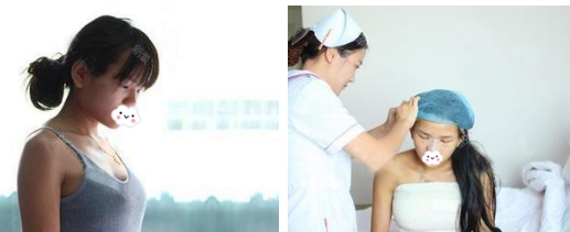 看了东莞丰胸医院排名后花两万多元找东莞美立方李志刚做了玉兔动感隆胸手术