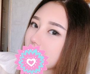 在洛阳做了纹眉后感觉服务周到、价格亲民又来做了肋软骨隆鼻 图2