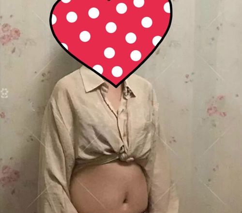 仅仅用了90天,我找赣州薇琳钟林辉做腰腹环吸后裤子直接从XL瘦到了M号