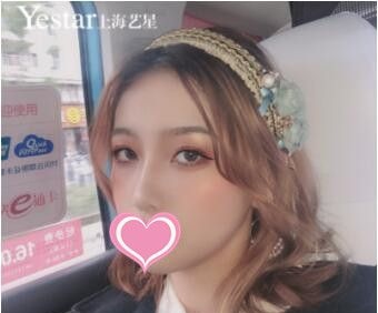 双眼皮和隆鼻能够一起做吗?我在上海艺星做的眼综合+鼻综合一起做后效果更好 图2