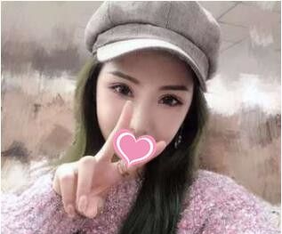 对之前割过双眼皮形状不满意的我在上海丽质做了眼修复价格优惠效果好 图2