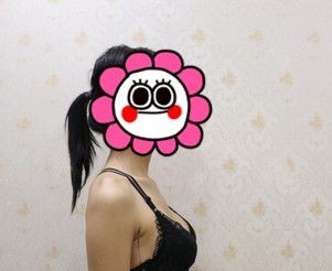 杭州艺星万连壮隆胸比较出名找他做了胸修复,用的是曼托假体花了二万多