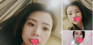 我也是做了一次双眼皮才知道西安西美整形医院怎么样?各方面来讲它的正规靠谱程度 图2