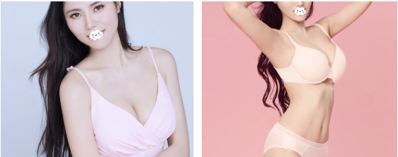 感觉身边去深圳非凡隆胸的人挺多的于是我也慕名找梅够明做了娜绮丽假体隆胸 图2