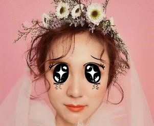 纠结鼻翼缩小术后越变越大,不如看我在太原这家医院术后68天的真实情况再考虑要不要手术 图2