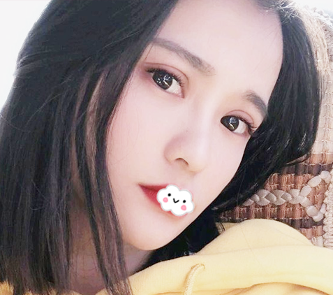 找东莞美立方做眼睛很好的张克医生做完双眼皮修复后拿到一份割双眼皮价格表 图2