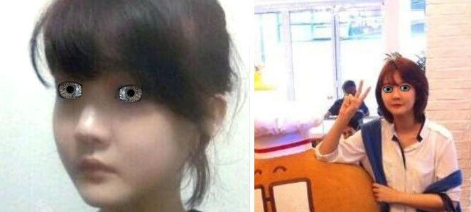 选择有磨骨资质的武汉五洲莱美整形美容医院做双鄂手术后改善了我的“鞋拔子”脸 图2
