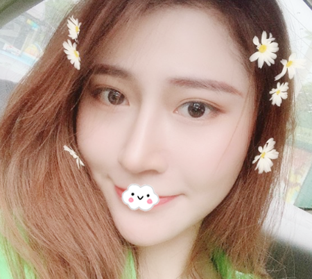 找正规靠谱的广州紫馨整形医院谷琪做完肋软骨隆鼻后拿到一份整形价格表 图2