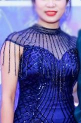 找宁波壹加壹郭光烨做了假体隆胸后感觉技术不错推荐给大家 案例图2