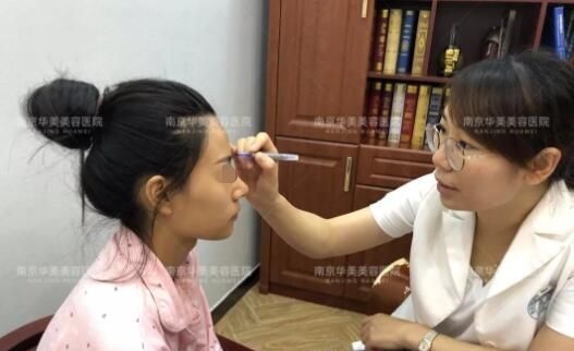 高颧骨的她面诊南京华美做自体脂肪填充全面部改善凹陷太阳穴+额面部后不用磨骨了
