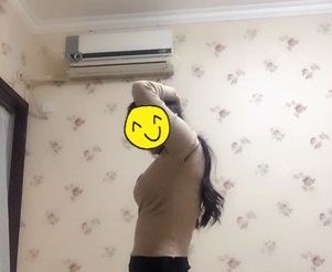 易胖MM投稿真人案例:选太原华美做腰腹吸脂后终于和肚子上松弛的肉肉说再见了 图2